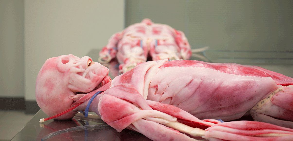 5 Medical Technologies Straight out of Horror Movies